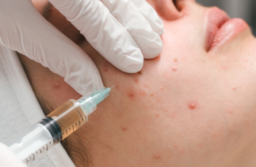 مشاوره پوست