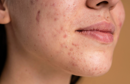 مراقبت روزانه پوست