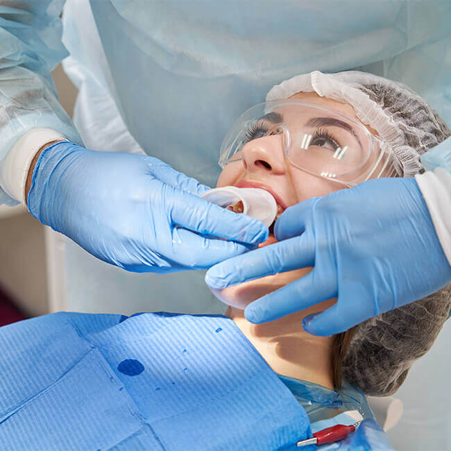 جرم‌گیری و بلیچینگ