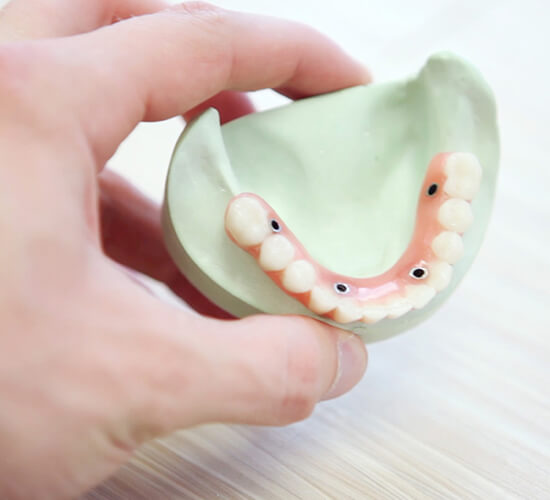 ایمپلنت دندان در تابادنت