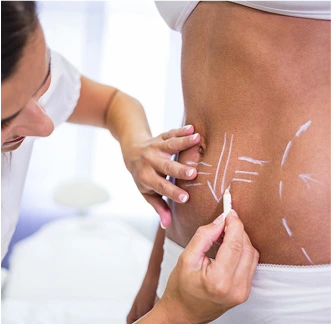 فرم‌دهی بدن در کلینیک وِنیس